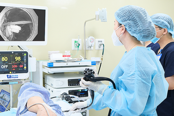 Nội soi gắp dị vật: Cây tăm trong dạ dày người đàn ông