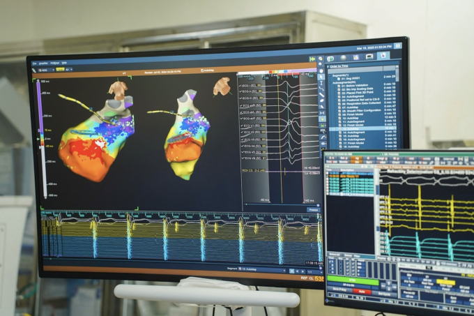 Hình ảnh hiển thị của bản đồ tim 3D trong quá trình can thiệp. Ảnh: Hạnh Quyên