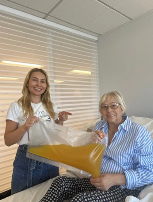 Natalia Naila giúp khoe túi vàng lỏng của mẹ cô, bà Venera, sau khi bà thực hiện trao đổi huyết tương tại phòng khám của tiến sĩ Dobri Kiprov ở San Francisco. Ảnh: NY Post