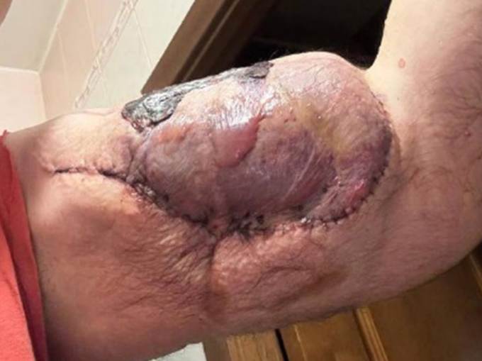 Cánh tay của Kirill Tereshin. Ảnh: Newsx