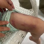 Bạo hành trẻ em: Mẹ và người tình bị bắt vì đánh con gái 9 tuổi